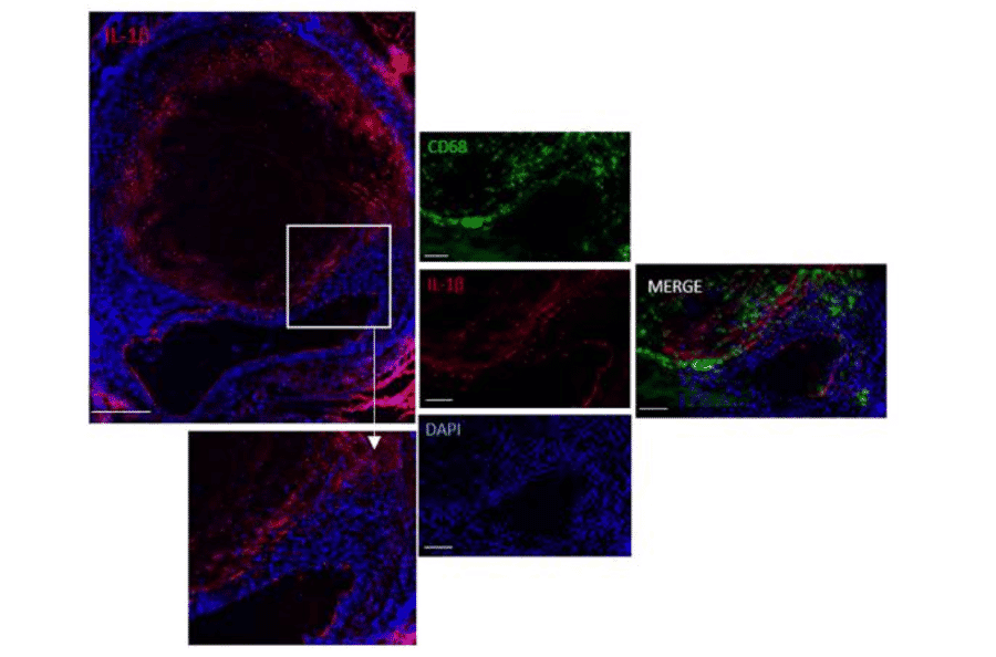 Immunofluorescnece - Anti-CD68 Antibody - Antibodies.com