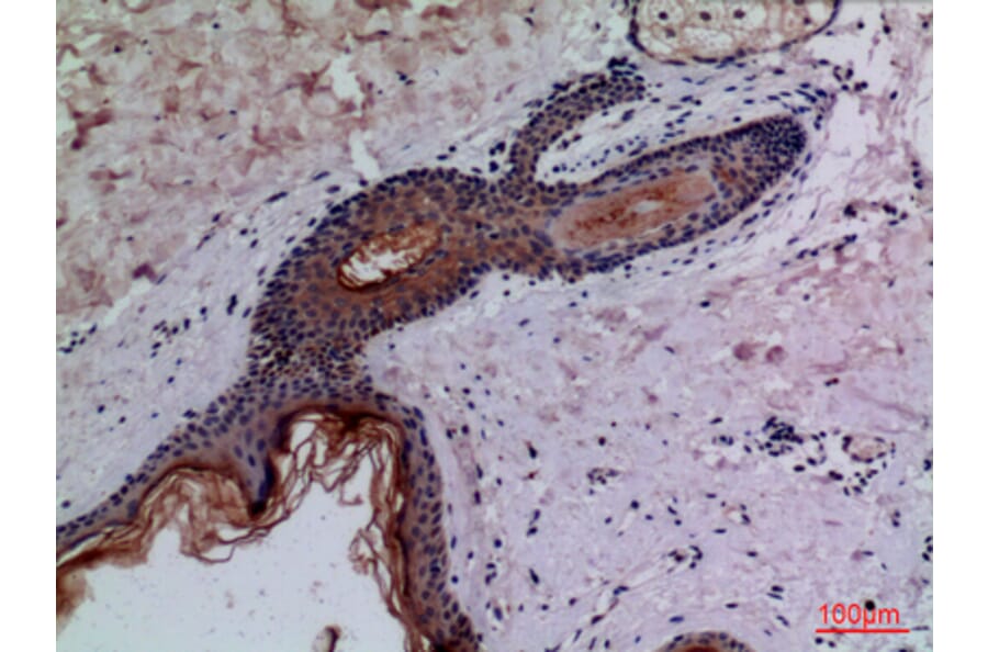 Immunohistochemistry - Anti-CD68 Antibody (C30188) - Antibodies.com