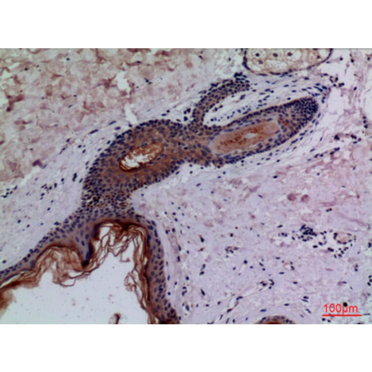Immunohistochemistry - Anti-CD68 Antibody (C30188) - Antibodies.com