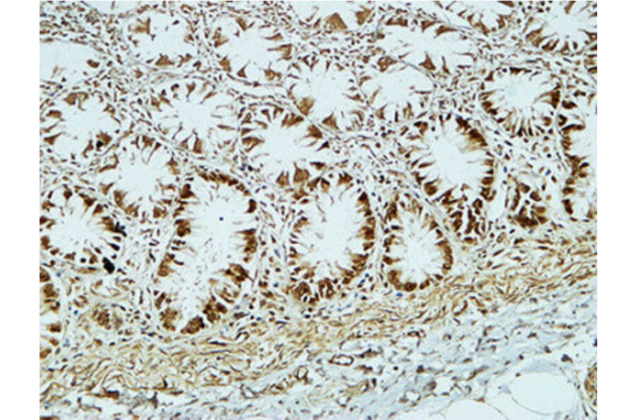 Immunohistochemistry - Anti-CD34 Antibody (R12-2075) - Antibodies.com