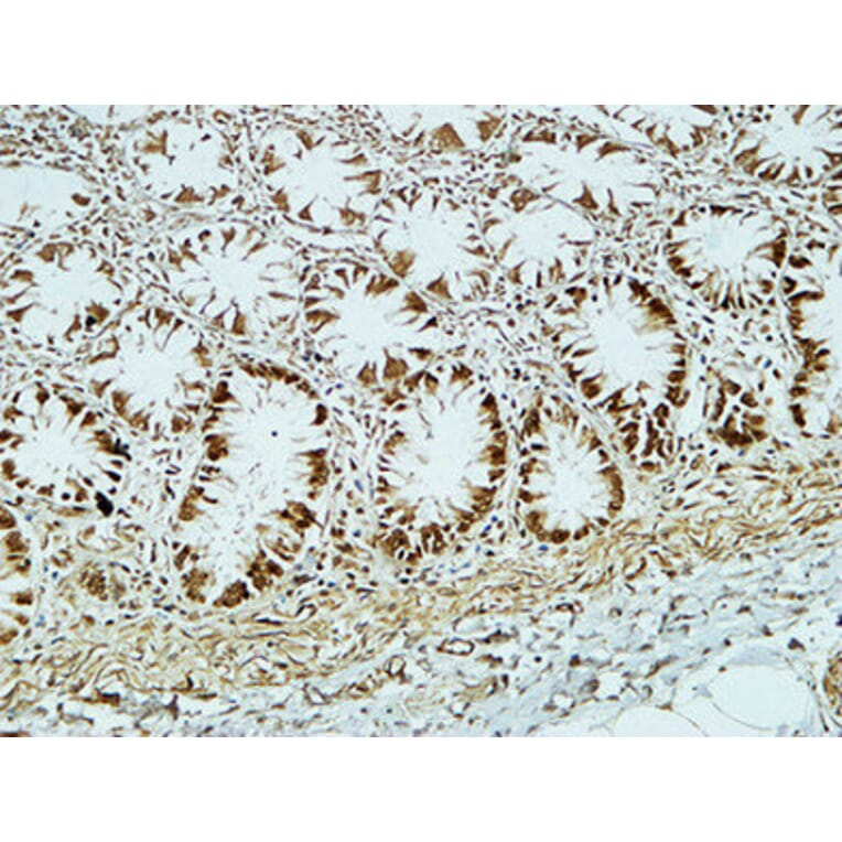 Immunohistochemistry - Anti-CD34 Antibody (R12-2075) - Antibodies.com