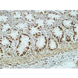 Immunohistochemistry - Anti-CD34 Antibody (R12-2075) - Antibodies.com