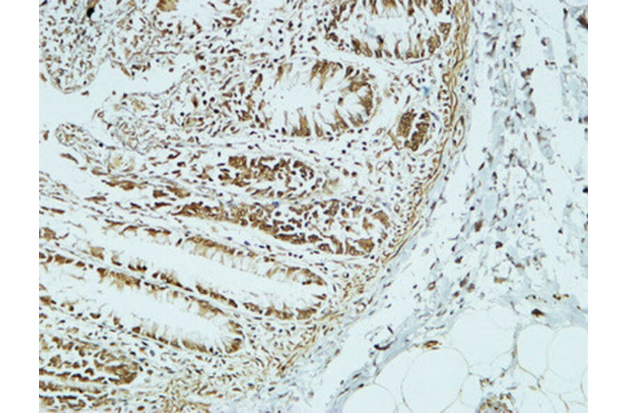 Immunohistochemistry - Anti-CD34 Antibody (R12-2075) - Antibodies.com