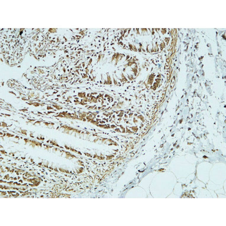Immunohistochemistry - Anti-CD34 Antibody (R12-2075) - Antibodies.com