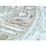Immunohistochemistry - Anti-CD34 Antibody (R12-2075) - Antibodies.com