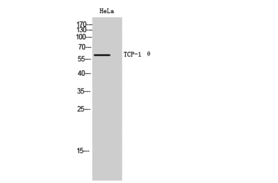 Western Blot - Anti-CCT8 Antibody (C19087) - Antibodies.com