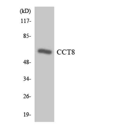 Western Blot - Anti-CCT8 Antibody (R12-2583) - Antibodies.com