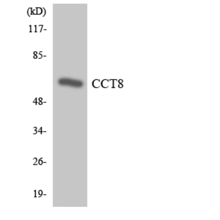 Western Blot - Anti-CCT8 Antibody (R12-2583) - Antibodies.com