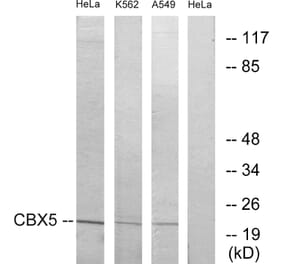 Western Blot - Anti-CBX5 Antibody (C10620) - Antibodies.com