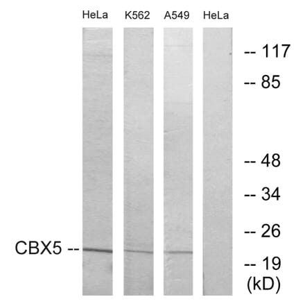 Western Blot - Anti-CBX5 Antibody (C10620) - Antibodies.com