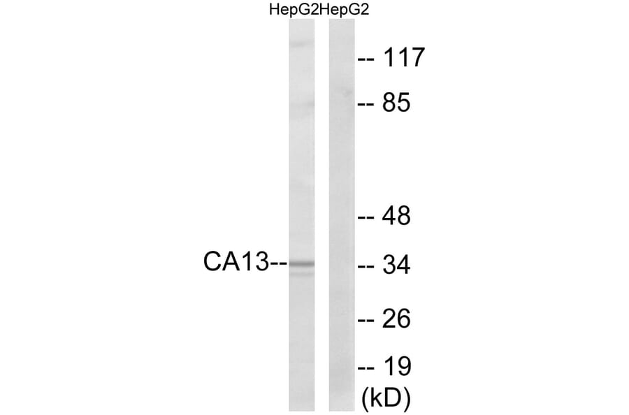 Western Blot - Anti-CA13 Antibody (C14936) - Antibodies.com