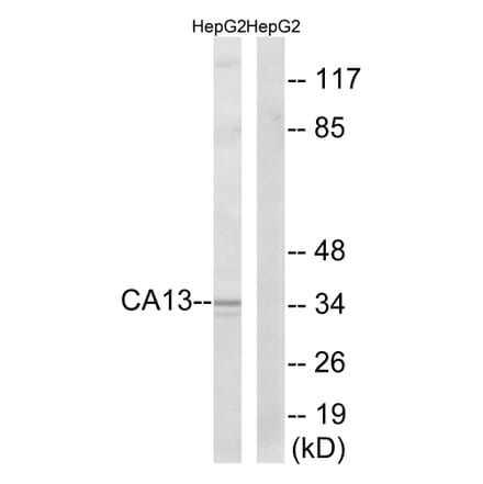 Western Blot - Anti-CA13 Antibody (C14936) - Antibodies.com