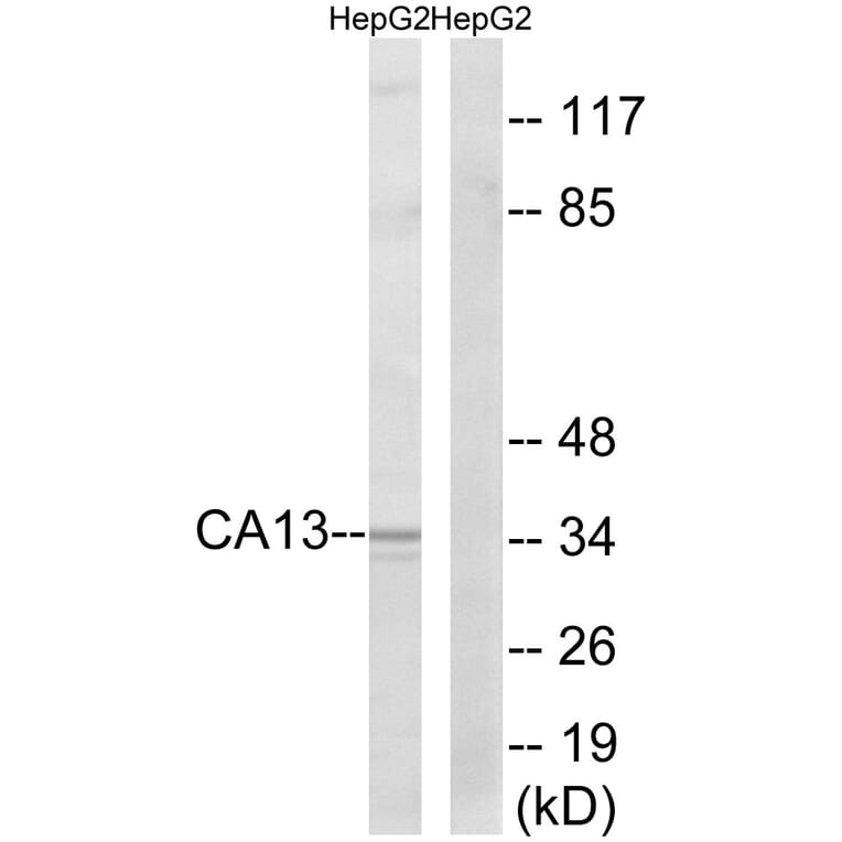 Western Blot - Anti-CA13 Antibody (C14936) - Antibodies.com