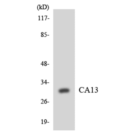 Western Blot - Anti-CA13 Antibody (R12-2555) - Antibodies.com