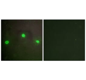Immunofluorescence - Anti-ATRX Antibody (C10627) - Antibodies.com