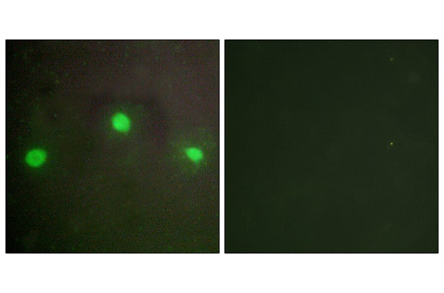 Immunofluorescence - Anti-ATRX Antibody (C10627) - Antibodies.com