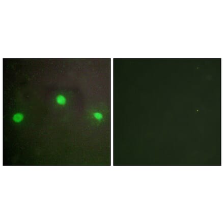 Immunofluorescence - Anti-ATRX Antibody (C10627) - Antibodies.com