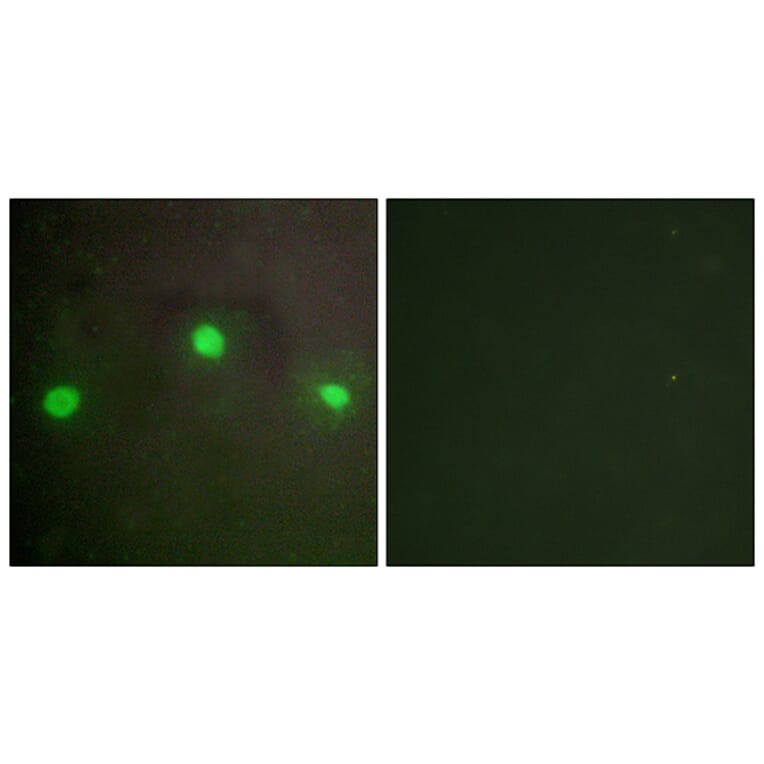 Immunofluorescence - Anti-ATRX Antibody (C10627) - Antibodies.com