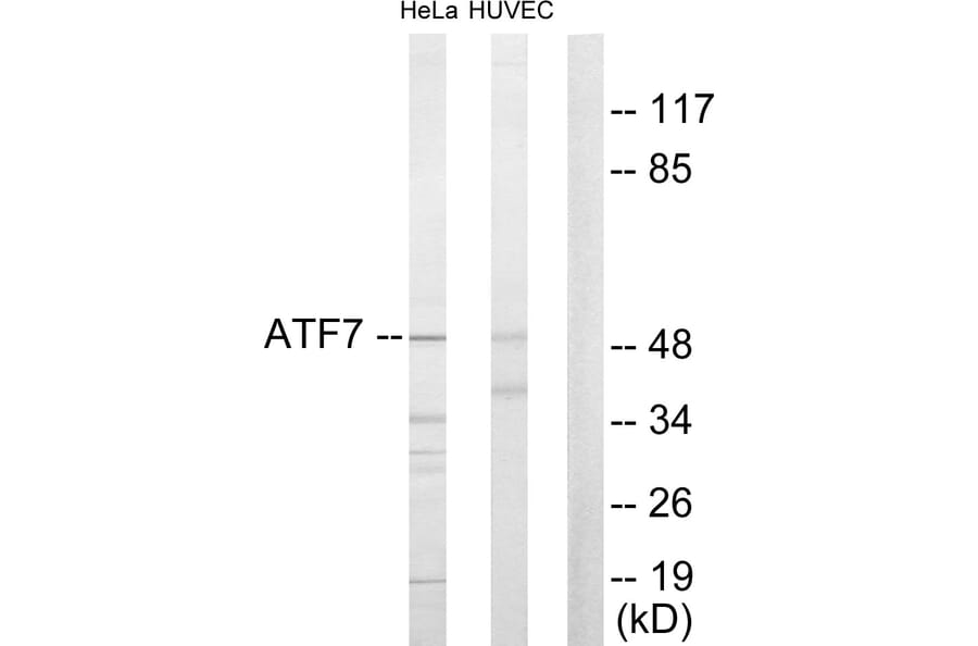 Western Blot - Anti-ATF7 Antibody (C10409) - Antibodies.com
