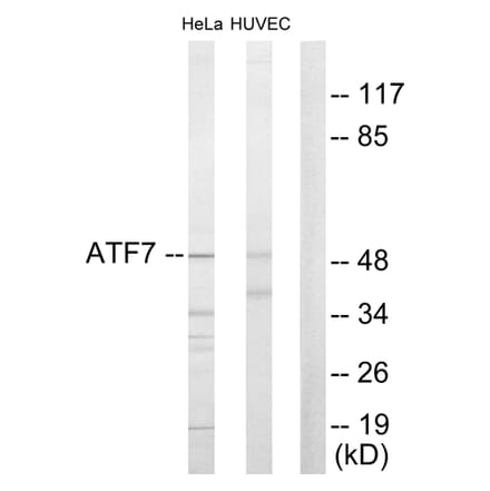 Western Blot - Anti-ATF7 Antibody (C10409) - Antibodies.com