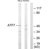 Western Blot - Anti-ATF7 Antibody (C10409) - Antibodies.com