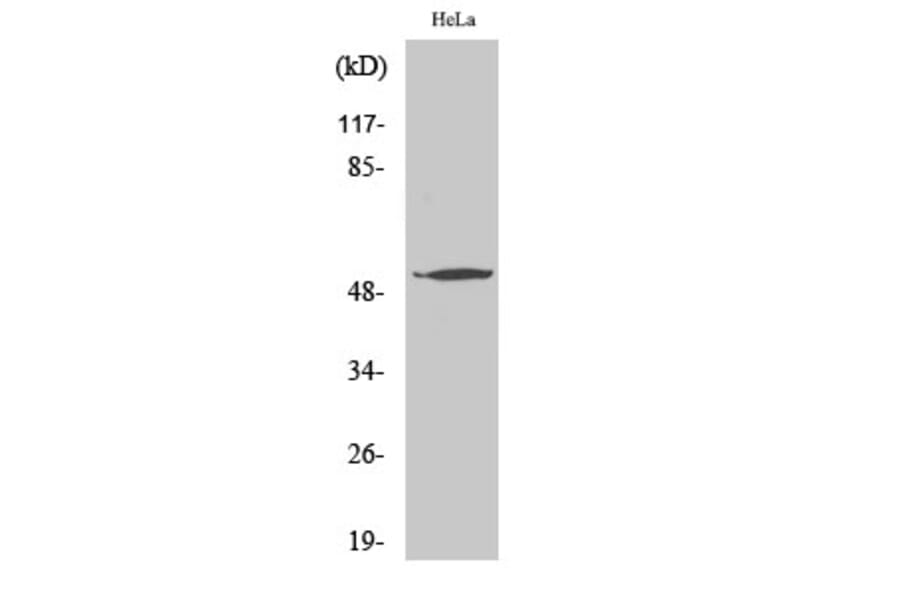 Western Blot - Anti-ATF7 Antibody (C10409) - Antibodies.com