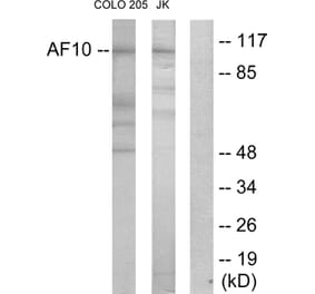 Western Blot - Anti-AF10 Antibody (C10737) - Antibodies.com
