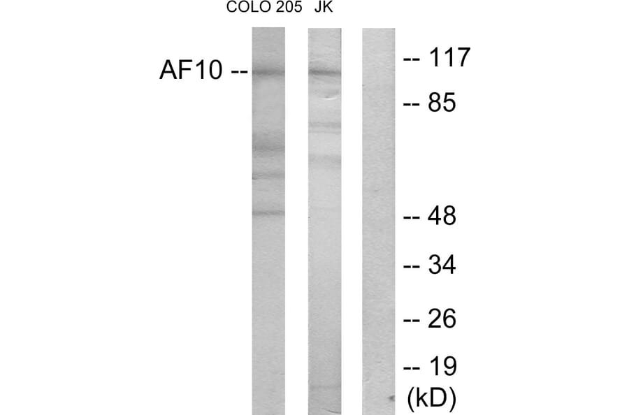 Western Blot - Anti-AF10 Antibody (C10737) - Antibodies.com