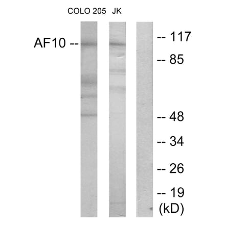 Western Blot - Anti-AF10 Antibody (C10737) - Antibodies.com