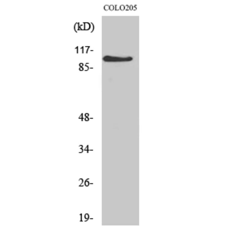Western Blot - Anti-AF10 Antibody (C10737) - Antibodies.com