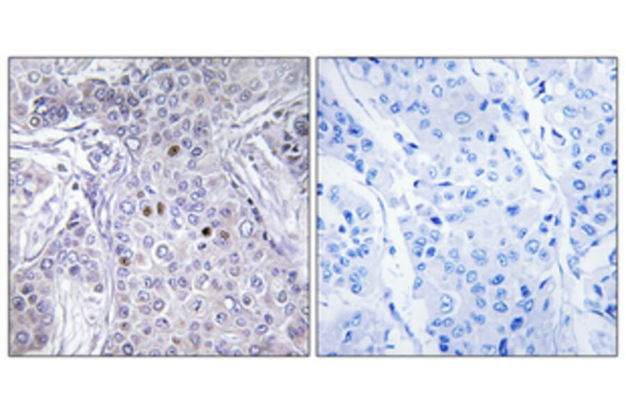 Immunohistochemistry - Anti-AF10 Antibody (C10737) - Antibodies.com
