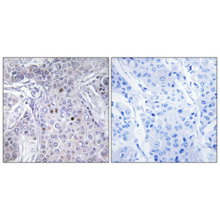 Immunohistochemistry - Anti-AF10 Antibody (C10737) - Antibodies.com