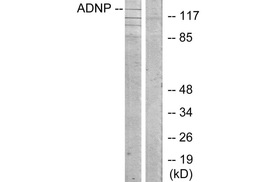 Western Blot - Anti-ADNP Antibody (C11685) - Antibodies.com
