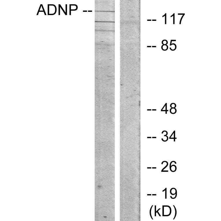 Western Blot - Anti-ADNP Antibody (C11685) - Antibodies.com