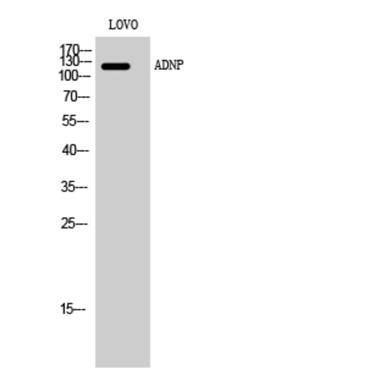 Western Blot - Anti-ADNP Antibody (C11685) - Antibodies.com