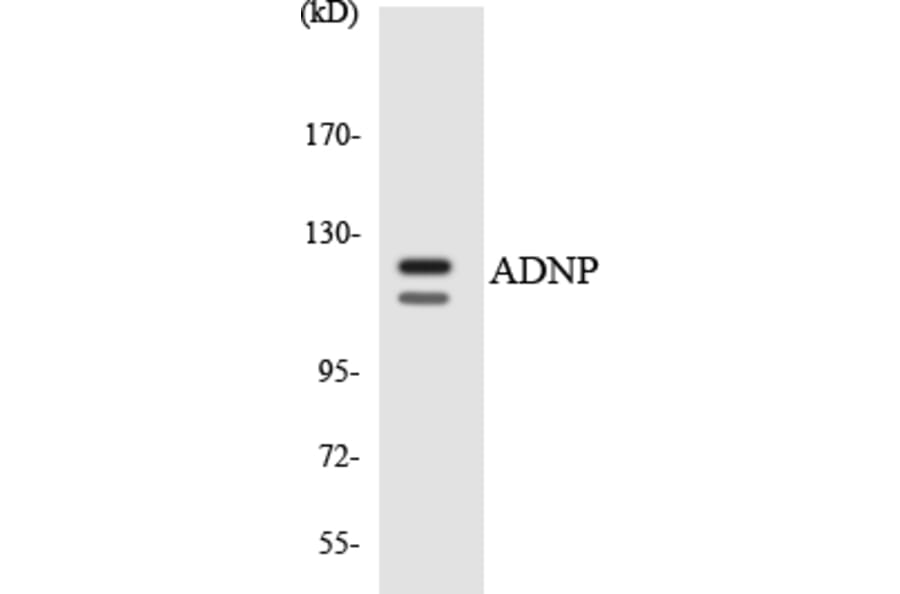 Western Blot - Anti-ADNP Antibody (R12-2451) - Antibodies.com