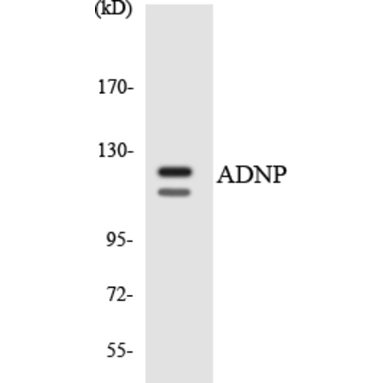 Western Blot - Anti-ADNP Antibody (R12-2451) - Antibodies.com