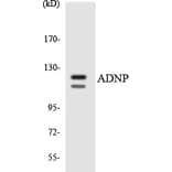Western Blot - Anti-ADNP Antibody (R12-2451) - Antibodies.com