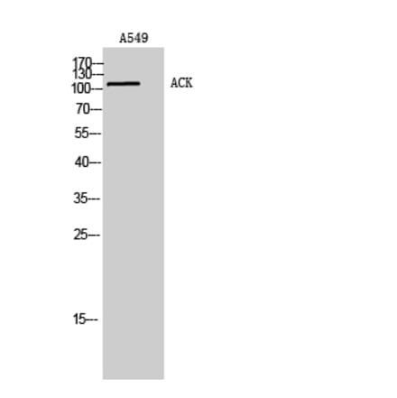 Western Blot - Anti-ACK1 Antibody (B0604) - Antibodies.com