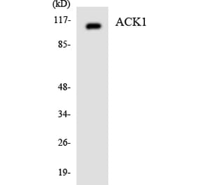 Western Blot - Anti-ACK1 Antibody (R12-2436) - Antibodies.com