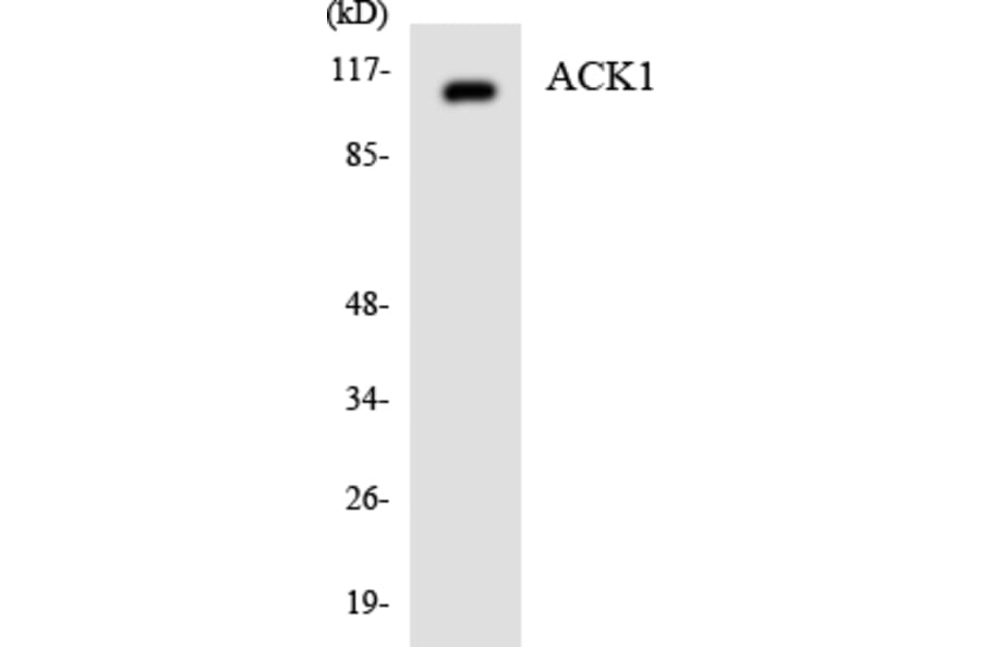 Western Blot - Anti-ACK1 Antibody (R12-2436) - Antibodies.com