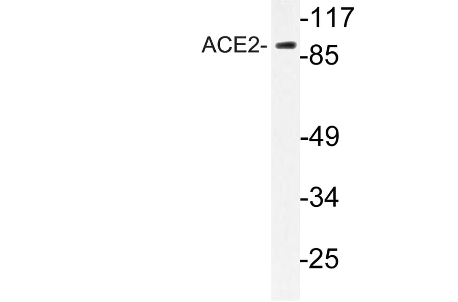 Western Blot - Anti-ACE2 Antibody (R12-2005) - Antibodies.com