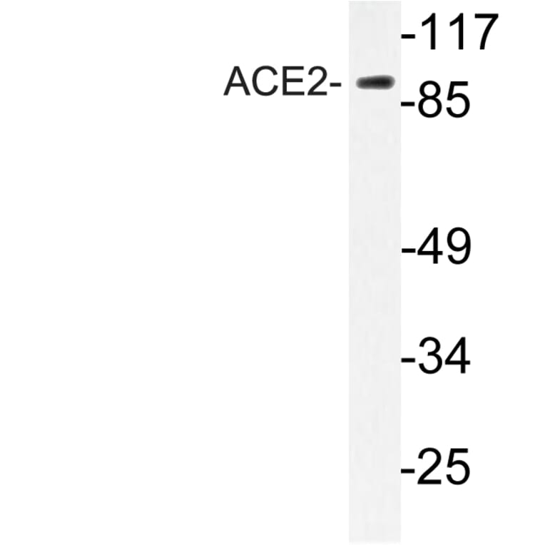 Western Blot - Anti-ACE2 Antibody (R12-2005) - Antibodies.com