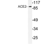 Western Blot - Anti-ACE2 Antibody (R12-2005) - Antibodies.com
