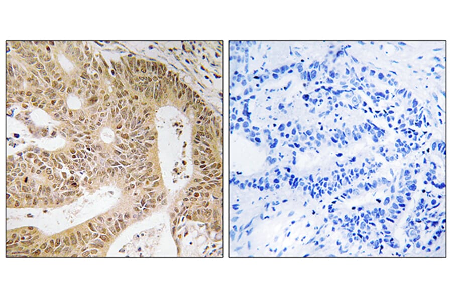 Immunohistochemistry - Anti-DAP Antibody (C12326) - Antibodies.com