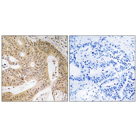 Immunohistochemistry - Anti-DAP Antibody (C12326) - Antibodies.com