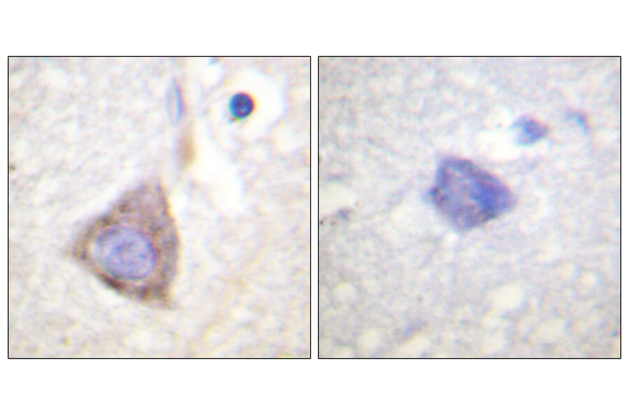 Immunohistochemistry - Anti-Bcr Antibody (B0776) - Antibodies.com