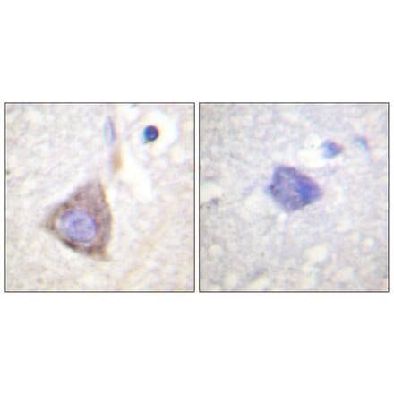 Immunohistochemistry - Anti-Bcr Antibody (B0776) - Antibodies.com