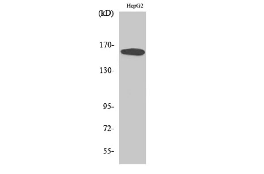 Western Blot - Anti-Bcr Antibody (B0776) - Antibodies.com