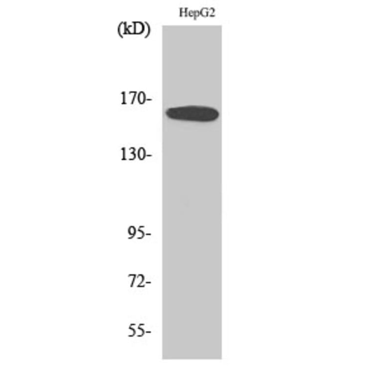 Western Blot - Anti-Bcr Antibody (B0776) - Antibodies.com